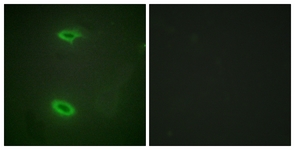 Immunofluorescence of HeLa cells, using DLGP1 Antibody. The picture on the right is treated with the synthesized peptide.
