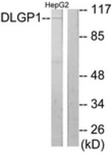 Western blot of extracts from HepG2 cells, using DLGP1 Antibody. The lane on the right is treated with the synthesized peptide.