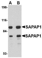 Western blot of SAPAP1 in rat brain tissue lysate with SAPAP1 antibody at (A) 0.5 and (B) 1 ug/ml.