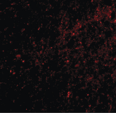Immunofluorescence of SAPAP3 in human brain tissue with SAPAP3 antibody at 20 ug/ml.