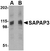 Western blot of SAPAP3 in rat brain tissue lysate with SAPAP3 antibody at (A) 1 (B) 2 ug/ml.