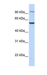 MCF7 cell lysate. Antibody concentration: 1.0 ug/ml. Gel concentration: 12%.