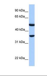 Fetal muscle lysate. Antibody concentration: 1.0 ug/ml. Gel concentration: 12%.