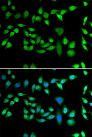 Immunofluorescence blot of U20S cell using DNAJB6 antibody. Blue: DAPI for nuclear staining.