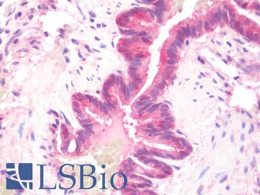 Anti-DNAJB6 / DnaJ antibody IHC staining of human lung. Immunohistochemistry of formalin-fixed, paraffin-embedded tissue after heat-induced antigen retrieval. Antibody LS-B10756 concentration 10 ug/ml.