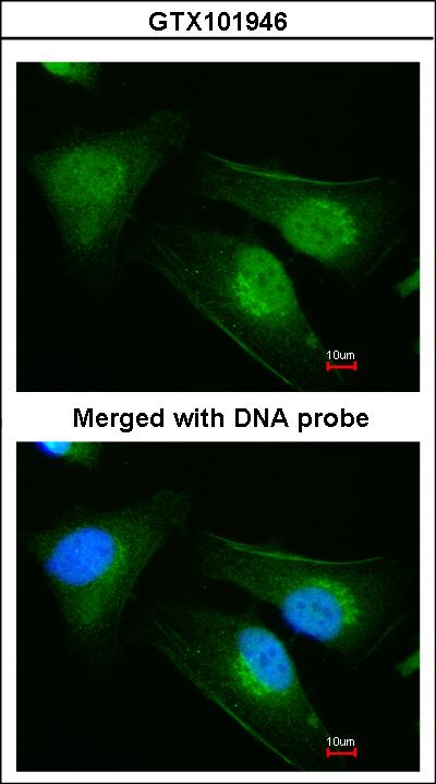 Immunofluorescence of paraformaldehyde-fixed HeLa using DNAJB6 antibody at 1:200 dilution.