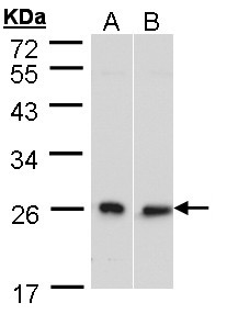 Sample (30 ug of whole cell lysate). A: HeLa S3, B: Molt-4 . 10% SDS PAGE. DNAJB6 / DnaJ antibody diluted at 1:500