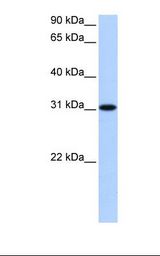 721_B cell lysate. Antibody concentration: 0.5 ug/ml. Gel concentration: 12%.