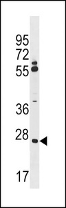 CNPY3 Antibody western blot of A2058 cell line lysates (35 ug/lane). The CNPY3 antibody detected the CNPY3 protein (arrow).