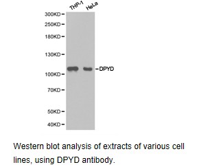 Western blot.