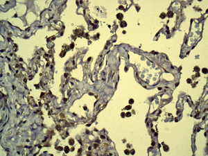 IHC of paraffin-embedded human lung tissue using anti-DPYD antibody.