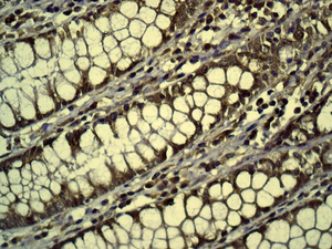 IHC of paraffin-embedded human colon tissue using anti-DPYD antibody.