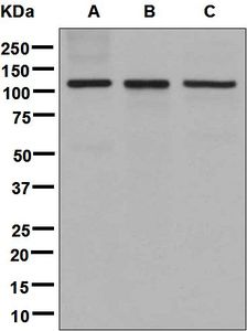 Western blot analysis on (A) fetal kidney, (B) THP-1, and (C) HeLa cell lysates using anti-DPYD antibody.