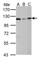 Sample (30 ug of whole cell lysate). A: Raji, B: K562, C: NCI-H929. 7.5% SDS PAGE. DPD antibody diluted at 1:1000.