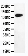 WB of DPYD / DPD antibody. All lanes: Anti-DPYD at 0.5ug/ml. WB: MM231 Whole Cell Lysate at 40ug. Predicted bind size: 111KD. Observed bind size: 111KD.
