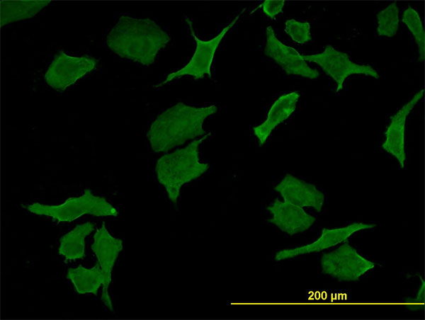 Immunofluorescence of monoclonal antibody to DPYD on HeLa cell. [antibody concentration 10 ug/ml]