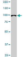 DPYD monoclonal antibody (M01), clone 7D4. Western Blot analysis of DPYD expression in HeLa NE.