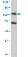 DPYD monoclonal antibody (M01), clone 7D4 Western Blot analysis of DPYD expression in HeLa.