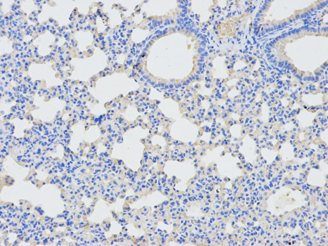 Immunohistochemistry of paraffin-embedded mouse lung using DPYD antibody at dilution of 1:100 (200x lens).