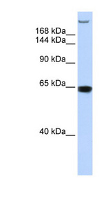 TNRC6A / GW182 antibody LS-C101879 Western blot of MCF7 cell lysate.
