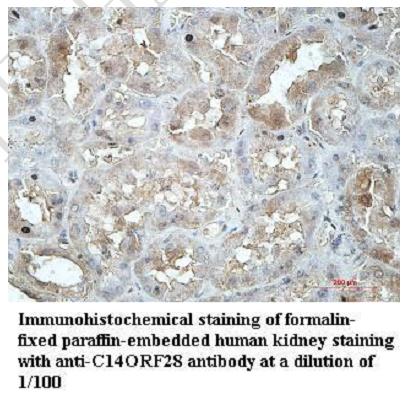 Immunohistochemistry of DRIP1 / C14orf28 antibody