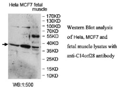 Western blot of DRIP1 / C14orf28 antibody