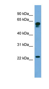 C14orf126 antibody LS-C117233 Western blot of 721_B cell lysate.