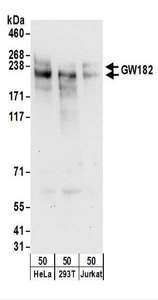 Detection of Human GW182 by Western Blot. Samples: Whole cell lysate (50 ug) from HeLa, 293T, and Jurkat cells. Antibodies: Affinity purified rabbit anti-GW182 antibody used for WB at 0.1 ug/ml. Detection: Chemiluminescence with an exposure time of 30 seconds.