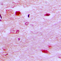 Immunohistochemical analysis of E2F6 staining in human brain formalin fixed paraffin embedded tissue section. The section was pre-treated using heat mediated antigen retrieval with sodium citrate buffer (pH 6.0). The section was then incubated with the antibody at room temperature and detected using an HRP conjugated compact polymer system. DAB was used as the chromogen. The section was then counterstained with hematoxylin and mounted with DPX.