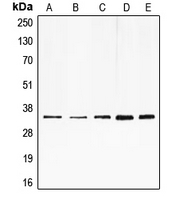 Western blot analysis of E2F6 expression in HeLa (A); HepG2 (B); K562 (C); mouse muscle (D); rat heart (E) whole cell lysates.