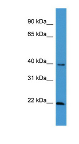 EBAG9 antibody LS-C135644 Western blot of THP-1 cell lysate.