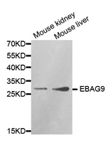 Western blot analysis of extracts of various cell lines, using EBAG9 antibody.