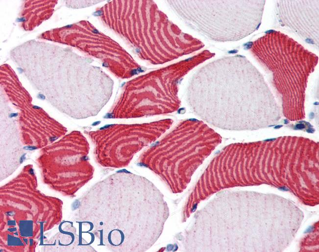 Anti-EBAG9 antibody IHC of human skeletal muscle. Immunohistochemistry of formalin-fixed, paraffin-embedded tissue after heat-induced antigen retrieval. Antibody LS-B2762 concentration 75 ug/ml.