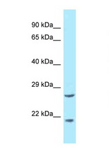 EEF1E1 / AIMP3 / p18 antibody LS-C146012 Western blot of 3 Cell lysate. Antibody concentration 1 ug/ml.