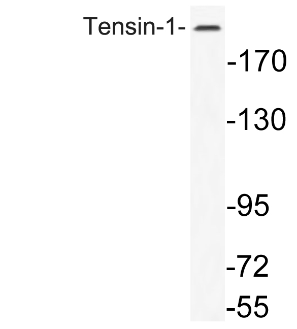 Western blot of Tensin-1 antibody in extracts from K562 cells.