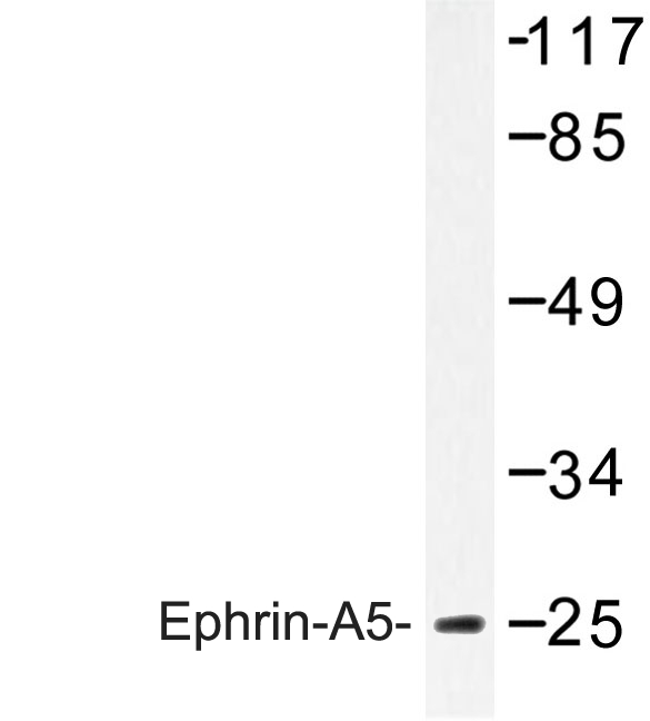 Western blot of Ephrin-A5 (P63) pAb in extracts from HeLa cells.
