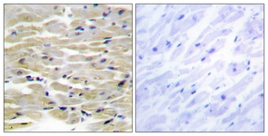 IHC of paraffin-embedded human heart tissue, using TENS3 Antibody. The sample on the right was incubated with synthetic peptide.