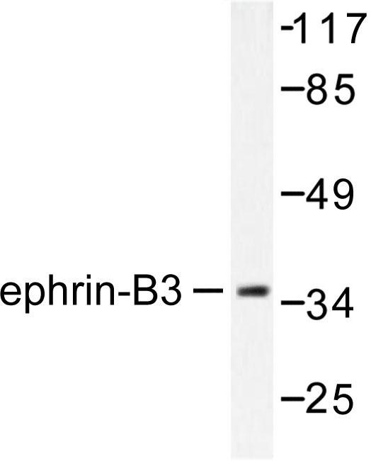 Western blot of Ephrin-B3 (W251) pAb in extracts from SKOV3 cells.