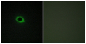Immunofluorescence of COS7 cells, using TENS3 Antibody. The sample on the right was incubated with synthetic peptide.