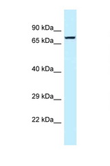 TNS4 antibody LS-C145873 Western blot of MCF7 Cell lysate. Antibody concentration 1 ug/ml.