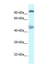 Western blot of Rat Muscle lysate. EGLN2 / PHD1 Antibody concentration 1 ug/ml.