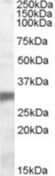 Antibody (0.1 ug/ml) staining of Human Muscle lysate (35 ug protein in RIPA buffer). Primary incubation was 1 hour. Detected by chemiluminescence.