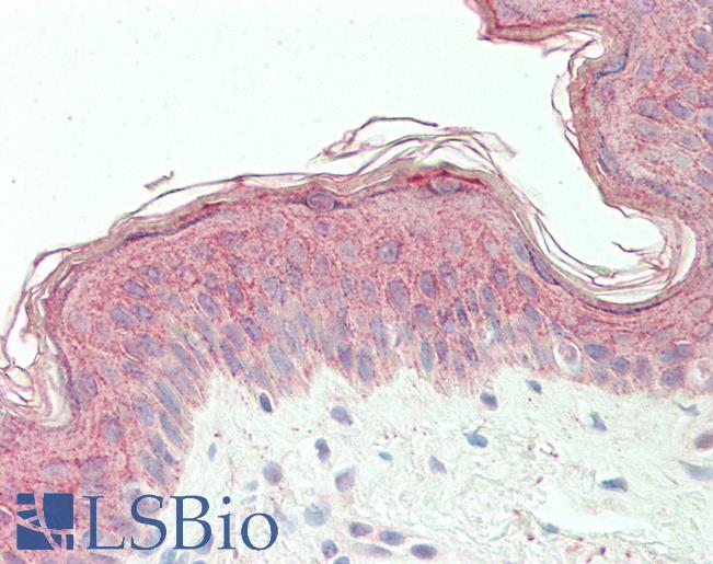 Anti-PHD3 / EGLN3 antibody IHC staining of human skin. Immunohistochemistry of formalin-fixed, paraffin-embedded tissue after heat-induced antigen retrieval. Antibody LS-B11293 concentration 5 ug/ml.