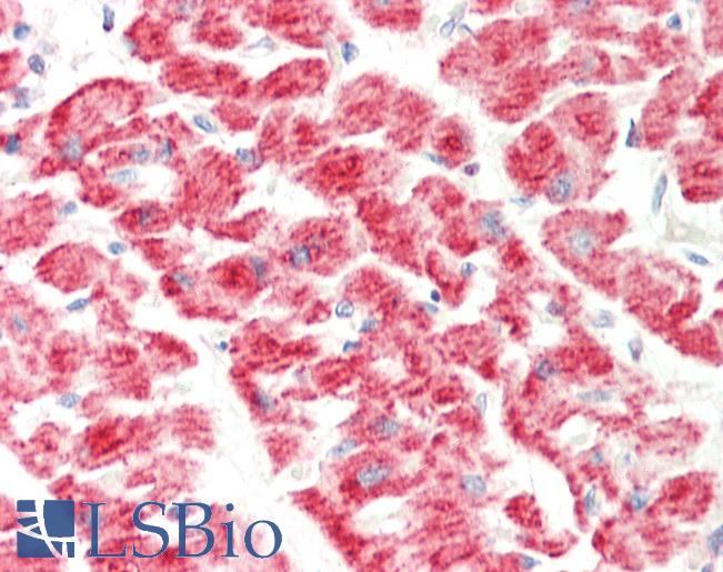 Human Heart: Formalin-Fixed, Paraffin-Embedded (FFPE)