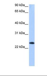Human fetal brain cell lysate. Antibody concentration: 1.0 ug/ml. Gel concentration: 12%.