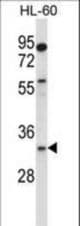 EGLN3 Antibody western blot of HL-60 cell line lysates (35 ug/lane). The EGLN3 antibody detected the EGLN3 protein (arrow).