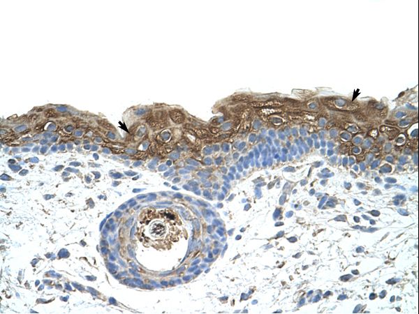 EIF2A antibody LS-C31788 was used in IHC to stain formalin-fixed, paraffin-embedded human skin.