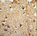Formalin-fixed and paraffin-embedded human brain tissue reacted with EIF2A Antibody , which was peroxidase-conjugated to the secondary antibody, followed by DAB staining. This data demonstrates the use of this antibody for immunohistochemistry; clinical relevance has not been evaluated.