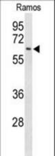 Western blot of EIF2A Antibody in Ramos cell line lysates (35 ug/lane). EIF2A (arrow) was detected using the purified antibody.