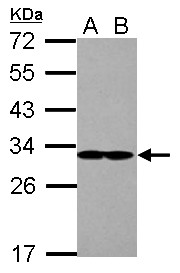 Sample (30 ug of whole cell lysate) A: A431 B: Jurkat 12% SDS PAGE EIF2B1 / EIF2B antibody diluted at 1:10000